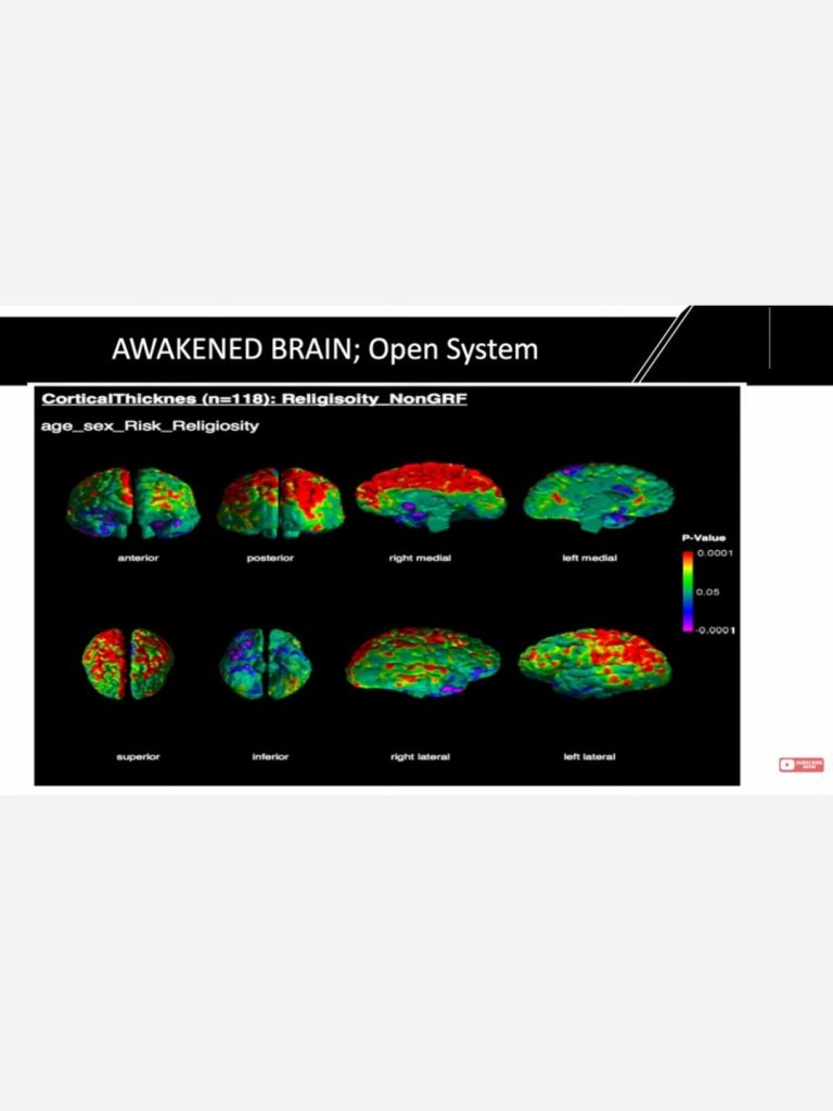 science-spirituality-neuroscience-points-to-ancient-wisdom An MRI Test showing the Cortical Thickness of an awakened brain, in eight different angles.